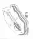 Fig. 09 - Subcutaneous sinusoidal wound closure utilizing one-way suture