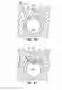 Fig. 37 - Subcutaneous sinusoidal wound closure utilizing one-way suture