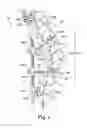 Fig. 02 - DEFORMITY ALIGNMENT SYSTEM WITH REACTIVE FORCE BALANCING