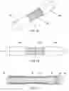 Fig. 02 - FLEXIBLE ROD ASSEMBLY FOR SPINAL FIXATION