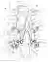 Fig. 01 - Device to protect adjacent stages of a spinal segment