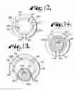 Fig. 06 - Polyaxial bone screw assembly