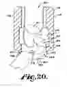 Fig. 11 - Polyaxial bone screw assembly