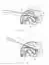 Fig. 03 - Surgical tool and method