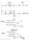 Fig. 02 - Apparatus and method for analyzing patient tolerance to a stimulation mode favoring a spontaneous atrioventricular conduction
