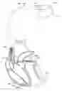 Fig. 01 - Method and system for overdriving a heart chamber during a threshold search according to an AV delay