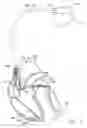 Fig. 02 - Method and system for overdriving a heart chamber during a threshold search according to an AV delay