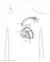 Fig. 01 - Systems and methods for programming implantable medical devices