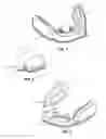 Fig. 02 - LIGHT THERAPY METHODS