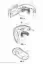 Fig. 04 - LIGHT THERAPY METHODS