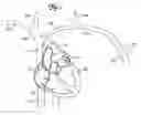 Fig. 02 - METHODS AND SYSTEMS FOR ANTI-THROMBOTIC INTRAVASCULAR IMPLANTABLE DEVICES