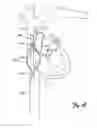 Fig. 06 - METHODS AND SYSTEMS FOR ANTI-THROMBOTIC INTRAVASCULAR IMPLANTABLE DEVICES