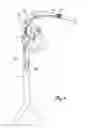 Fig. 07 - METHODS AND SYSTEMS FOR ANTI-THROMBOTIC INTRAVASCULAR IMPLANTABLE DEVICES