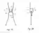 Fig. 07 - IMPLANTABLE VASCULAR GRAFT