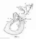 Fig. 02 - HEART VALVE REPAIR APPARATUS AND METHODS