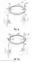 Fig. 08 - HEART VALVE REPAIR APPARATUS AND METHODS