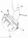 Fig. 01 - Acetabular prosthetic system with simplified impaction