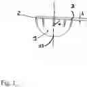 Fig. 02 - Acetabular prosthetic system with simplified impaction