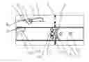 Fig. 01 - Negative pressure care bed