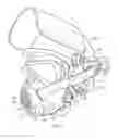 Fig. 02 - MASK SECURING DEVICE