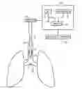 Fig. 01 - Method and system for determining tracheal and location information for a tracheal tube