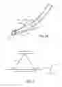 Fig. 04 - Method and system for determining tracheal and location information for a tracheal tube