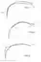 Fig. 07 - Hybrid bit with variable exposure