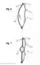 Fig. 06 - Acoustic baffle