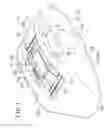 Fig. 02 - OPPOSED-PISTON CALIPER BODY