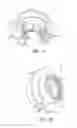Fig. 10 - Systems, Apparatus and Methods for Vacuum Filtration