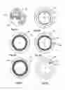 Fig. 04 - Foam dispensing assembly