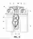 Fig. 03 - AUTOMATIC DUAL-SPRAY DISPENSER DEVICE