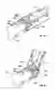 Fig. 07 - Surgical instrument with articulating tool assembly