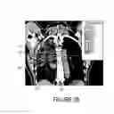 Fig. 09 - Method for three dimensional (3D) lattice radiotherapy