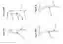 Fig. 03 - Ergonomic wheelchair propulsion system