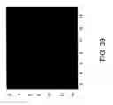 Fig. 43 - Reference structures and reference structure enhanced tomography