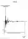 Fig. 09 - Audio signal processing device and audio signal processing method