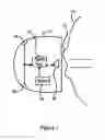 Fig. 02 - Frequency control based on device properties