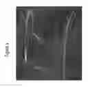 Fig. 06 - System for detecting catheterization devices