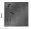 Fig. 08 - System for detecting catheterization devices
