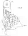 Fig. 03 - METHOD FOR LAND STABILIZATION