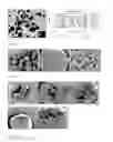 Fig. 04 - COMPOSITIONS AND METHODS FOR AUGMENTATION AND REGENERATION OF LIVING TISSUE IN A SUBJECT