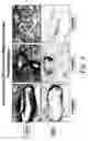 Fig. 07 - METHODS OF USING CADHERIN 11 (CDH11) ANTAGONISTS