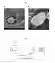 Fig. 02 - PHARMACEUTICAL COMPOSITION FOR TREATING AVELLINO CORNEA DYSTROPHY COMPRISING AN ANTIBODY AGAINST TGF-BETA