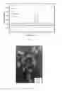 Fig. 08 - Peptidomimetic Resorbable Peptide-Polymer Hybrid Polyester Nanoparticles