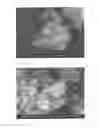 Fig. 02 - CALCIUM PHOSPHATE COMPOSITION AND PROCESS FOR PRODUCTION THEREOF