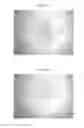 Fig. 09 - METHODS AND THERAPEUTIC COMPOSITIONS COMPRISING PLANT EXTRACTS FOR THE TREATMENT OF CANCER