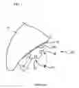 Fig. 02 - Orthodontic bracket