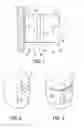 Fig. 02 - Orthodontic treatment methods, systems and apparatus for use therewith