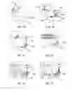 Fig. 02 - Method and system for fixing removable dentures